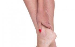 ankle pain 2