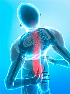 back-pain