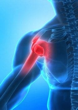 shoulder-pain