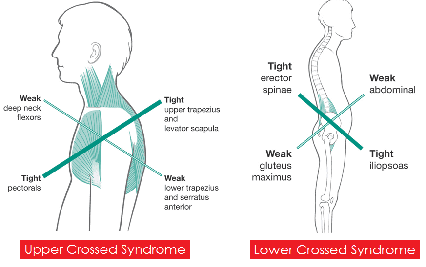 Weak lower back discount muscles